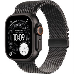 Milanese Loop